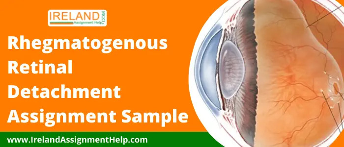 Rhegmatogenous Retinal Detachment Assignment Sample 